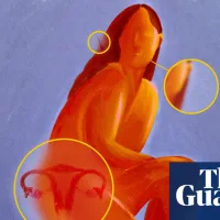 Can a name change transform PCOS outcomes for women? – podcast