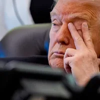 Trump Sports Swollen Eye Days After Surprise Medical Checkup